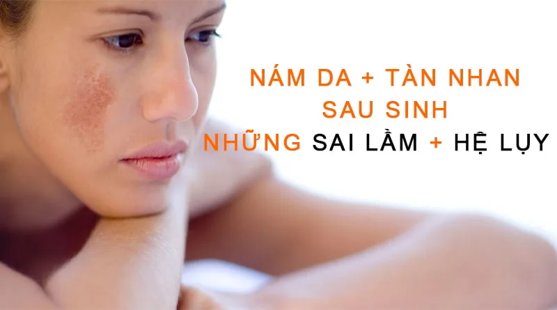 cải thiện nám sau sinh an toàn