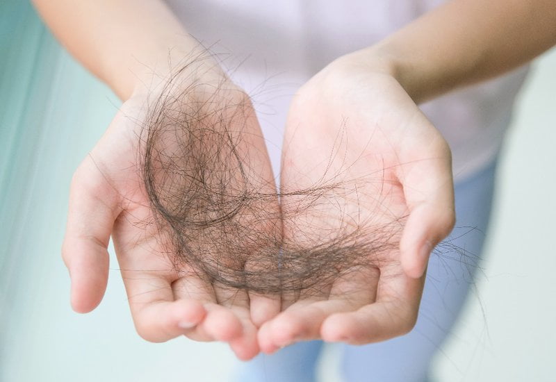rối loạn nội tiết tố gây rụng tóc là gì